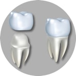 Dental Implants, Dental Veneers and Cosmetic Dentistry in Reynosa Mexico.